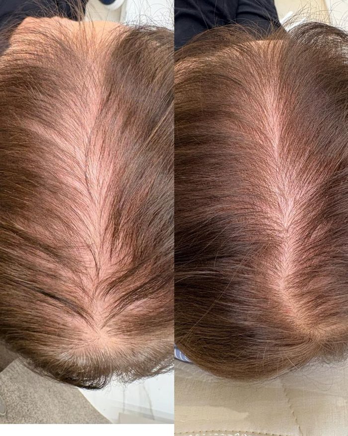 Antes e depois na linha de separação do cabelo